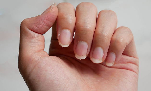 What vitamin are you lacking when your nails split? - Quora